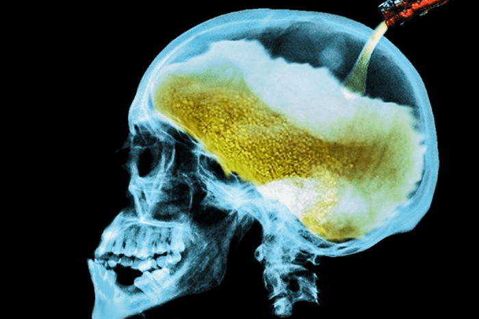 Lee más sobre el artículo Los efectos del alcohol en el cuerpo humano